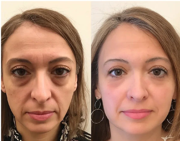 Contorno de Ojos con Colágeno
